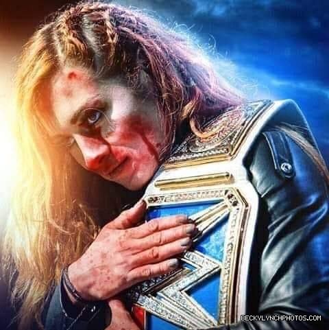 BeckyLynchWWE-1069032117743570944-20181201_185453-img1.jpg