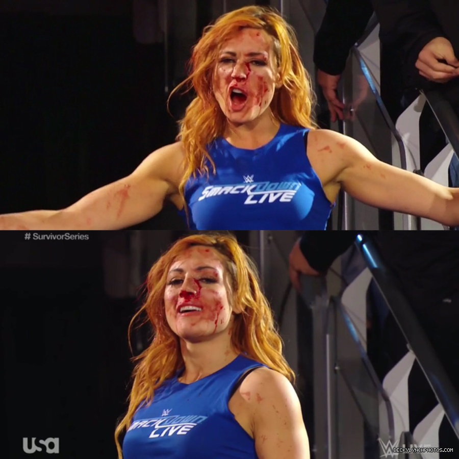 BeckyLynchWWE-1062395955511808002-20181113_112508-img1.jpg